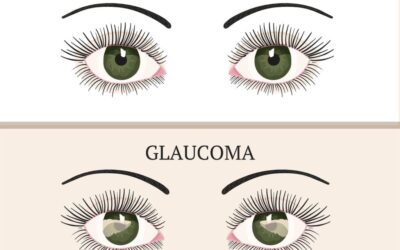 Causes and Treatments of Glaucoma in Elderly Adults